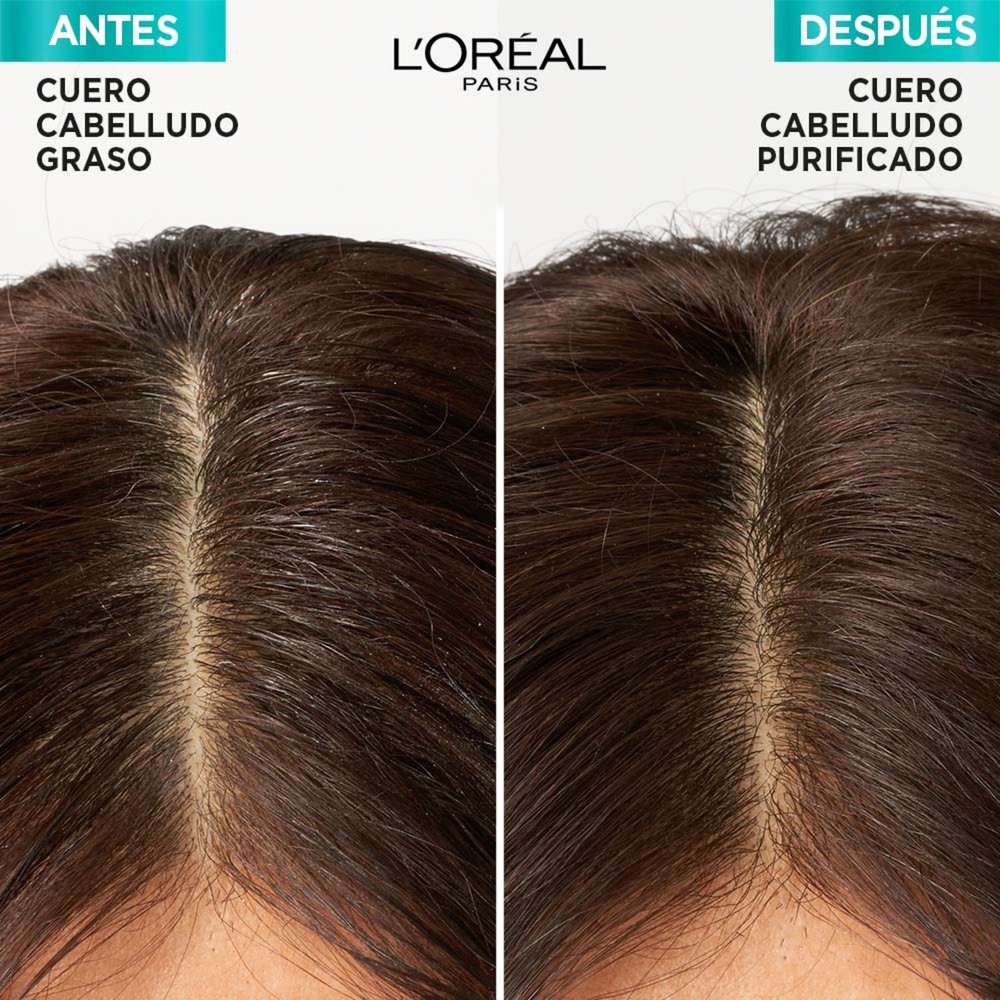 elvive hialurónico pure de L’Oreal Paris antes y después